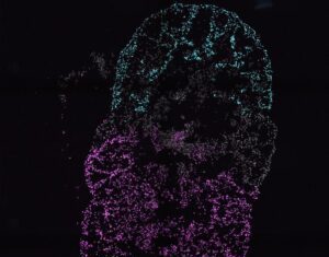 Multi-Chambered Heart Organoids Allow Study of Organ Development and Defects