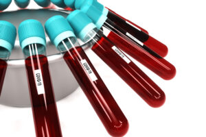 Blood Testing Identifies Biomarkers of Suicidal Thoughts