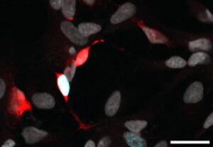Human Glia Reprogrammed into Neuron-Generating Cells