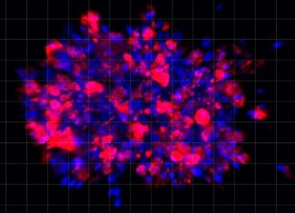Scientists use organoid model to identify potential new pancreatic cancer treatment