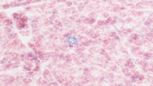 CAR T Cells Target Senescent Cells, Reduce Age-Related Declines in Mice