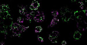 Obesity Held Back by Single Gene Deletion, Reversing Mitochnodrial Fission in Mice