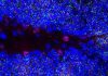 Down Syndrome Memory and Learning Deficits Linked to Long Noncoding RNA