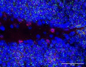 Down Syndrome Memory and Learning Deficits Linked to Long Noncoding RNA