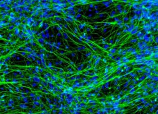 Uncovering anxiety: Scientists identify causative pathway and potential cures