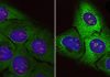 Accumulation of ‘junk proteins’ identified as one cause of aging and possible source of ALS
