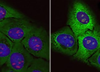 Accumulation of ‘junk proteins’ identified as one cause of aging and possible source of ALS
