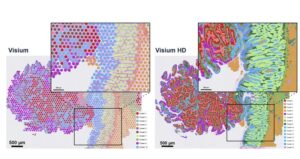 As 10x Launches Visium HD, Will Single Cell Resolution Draw New Customers?