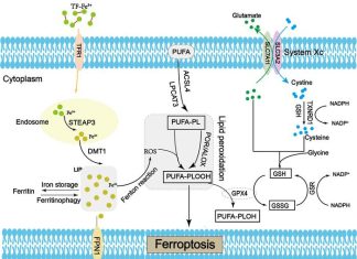 Chinese Medical Journal Review article explores ferroptosis in lung cancer