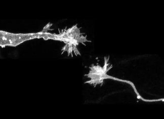 Deciphering the tip of migrating neurons: Discovery of growth cone in migrating neurons involved in promoting neuronal migration and regeneration in the brain after injury