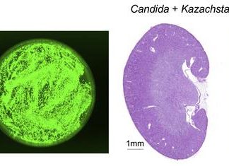 Newly identified yeast could prevent fungal infections by outcompeting rivals, study suggests