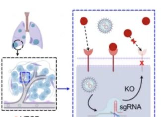 Precision pulmonary medicine: Penn engineers target lung disease with lipid nanoparticles