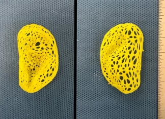 Researchers produce grafts that replicate the human ear