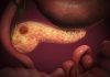 VUB researchers show xCT protein is key link in inhibiting pancreatic cancer growth and limiting mood disturbances
