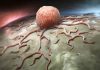 Longitudinal multi-omics monitoring paves the way for early pancreatic cancer diagnosis