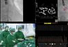Siriraj Hospital Shines Spotlight on TAVI Procedure as Alternative for High-Risk Patients Requiring Aortic Valve Replacement