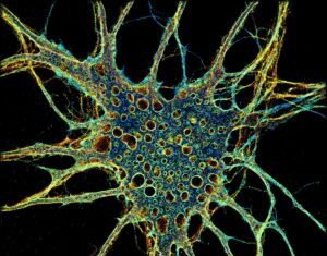 Super-Resolution Microscopy Can Be Super-Accessible