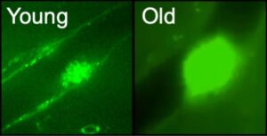 Platelet Pathway More Traveled with Age, Leads to Excessive Clotting