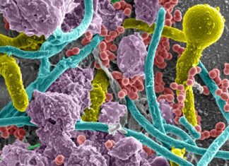 Researchers identify factors that heighten risk for catheter-associated urinary tract infections and sepsis