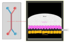 Cervix on a Chip Latest Advance for Women’s Health