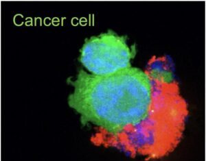 Nano-Immunotherapy Delivers Checkpoint Inhibition And Anticancer Drug to Lung Tumors in Mice