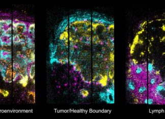 Spatial Transcriptomics Platform Promises Low-Cost, High-Res 3D Mapping