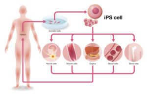 Using iPSCs as Starting Material for Advanced Therapies