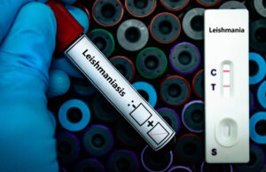 Leishmaniasis Research Gets Major Boost for Vaccine Development