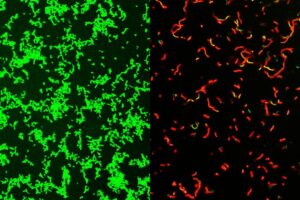 New Antibiotic Shows Promise against Gram-Positive Pathogen in Mice