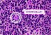 Siriraj Hospital Integrates AI to Elevate Medical Research and Diagnosis, Touts YOLO Model for Centroblast Cell Counting