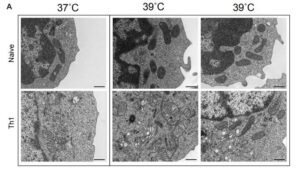 Fever’s Heat Causes Some T Cells to Wilt, Shrinking Anticancer Potential