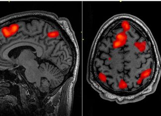 New normative neuroimaging library sets standard for brain injury research