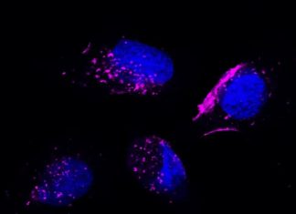 Singapore scientists to use exosomes secreted by living cells to successfully target TKI-resistant cancer