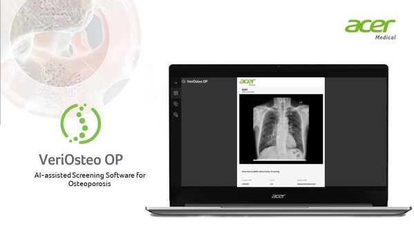 Acer Medical: VeriOsteo OP Obtains Medical Device Approval from Indonesia’s Ministry of Health