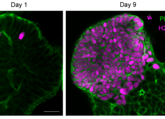 Intestinal Organoids Reveal Tuft Cells’ Role in Regeneration