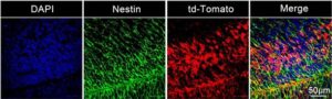 Prenatal Gene Therapy via LNPs Shows Promise in Model of Neurodevelopmental Disorder