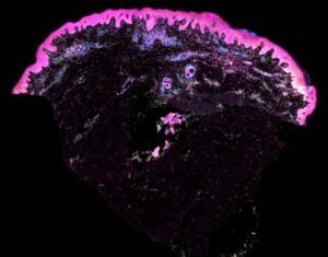 Single-Cell Analysis of Prenatal Skin and Skin Organoids Offers Scarless Skin Repair Clues