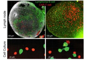 Lymphoma Immunotherapy Enhanced by Enzyme Inhibitor In Preclinical Model, Prompting Pilot Clinical Studies