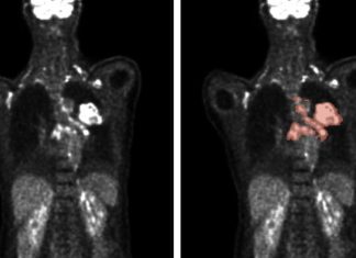 Advancements in Algorithms Enhance Medical Image Analysis through Artificial Intelligence