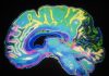 Key actions identified to improve post-acute care for TBI patients