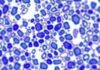 Mayo Clinic Introduces Digital Pathology Initiative to Revolutionize the Field and Accelerate Medical Advancements