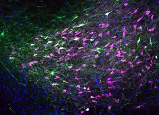 Sex Hormone Protects Against Opioid Misuse in Female Rats