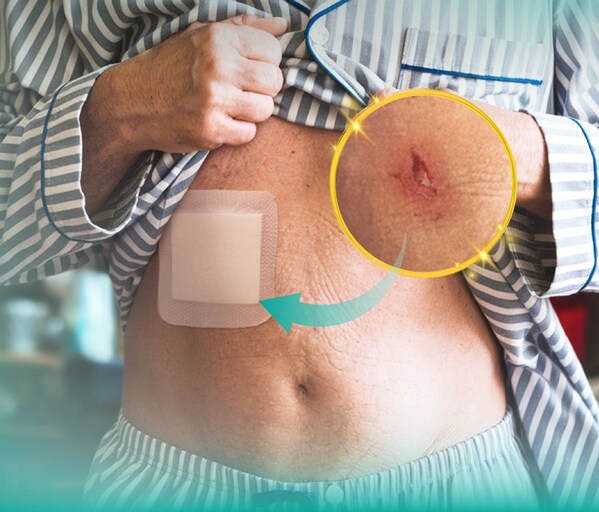 Wounds hard to heal? Troubled by dressing changes? Dimora, Amazon’s 3-year top brand, shows you the way.