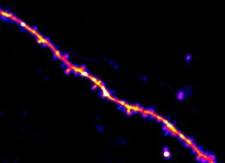 Distinct Dendrites, Distinct Rules for Learning in a Single Neuron Mouse Study