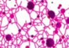 Link Between Parasitic Infections and Cancer-Related Gene Activity in Cervical Tissue Uncovered