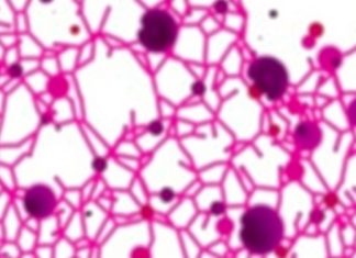 Link Between Parasitic Infections and Cancer-Related Gene Activity in Cervical Tissue Uncovered