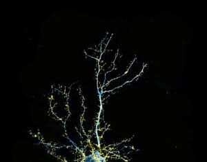 LSD Analog That May Have Potential for Treating Schizophrenia Developed