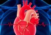 Malignant Arrhythmias Linked to Heart Valve Abnormalities, Study Finds