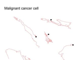 Scientists Differentiate Healthy and Cancerous Cells by Their Movement Patterns