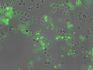 AI Predicts Protein Aggregation from Sequence to Address Neurological Disease